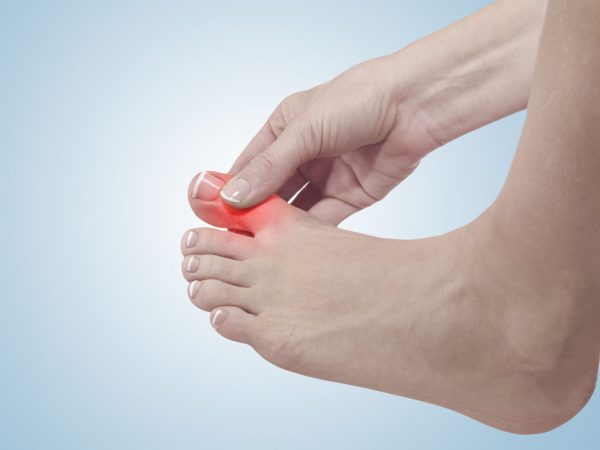 Truy tìm nguyên nhân gây tình trạng tê bì ngón chân cái