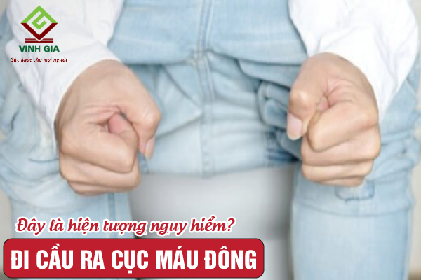 Đi cầu ra máu vón cục có phải là hiện tượng nguy hiểm?