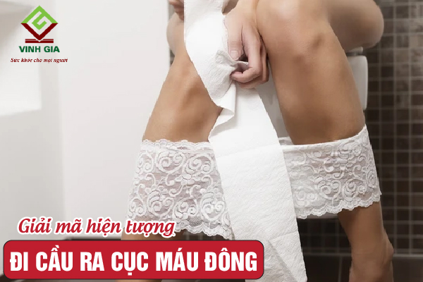 Giải mã hiện tượng đi cầu ra máu cục