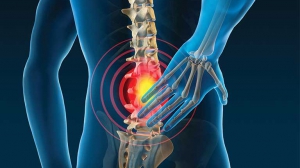 Nguyên nhân gây đau lưng cấp tính là gì?
