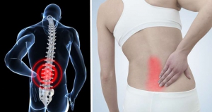 Đứng lâu bị đau lưng là bệnh gì? Có nguy hiểm không?