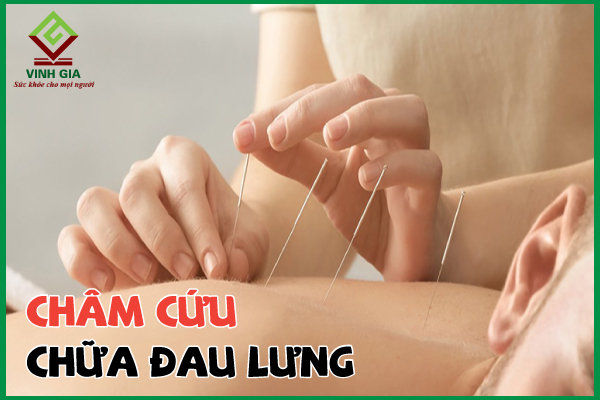 Có những phản ứng phụ nào sau khi châm cứu vùng lưng?
