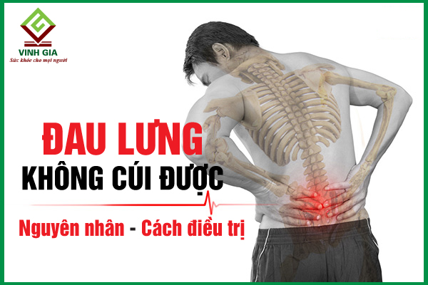 Liệu có phương pháp phòng ngừa nào để tránh bị đau lưng không cúi xuống?

