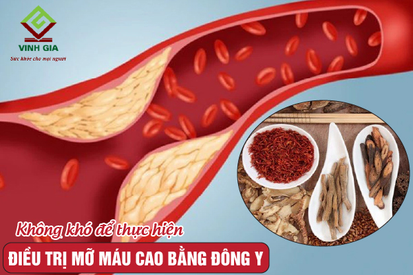 3. Các bài thuốc Đông y phổ biến điều trị mỡ máu cao