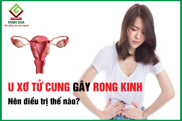 Tác động của u xơ tử cung đến quá trình mang thai?
