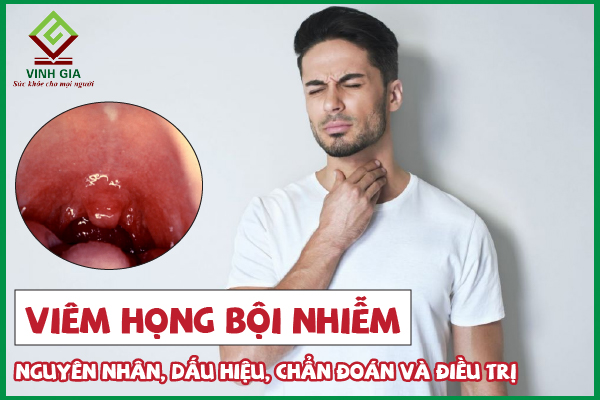 Viêm họng bội nhiễm có nguy hiểm không?
