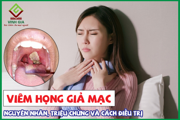 Viêm họng giả mạc có nguy hiểm không?
