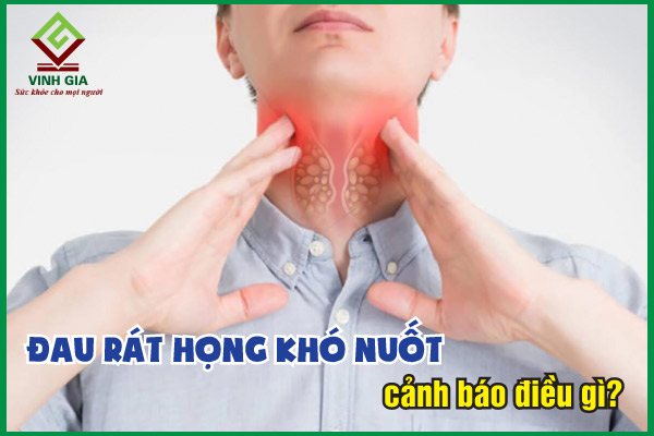 Triệu chứng cụ thể khi nuốt khó khăn liên quan đến cổ họng đau rát là gì?
