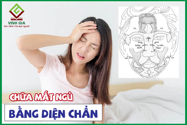 Diện chẩn chữa mất ngủ hiệu quả như thế nào?