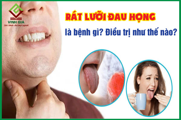 Rát lưỡi đau họng có thể do nguyên nhân gì gây ra?