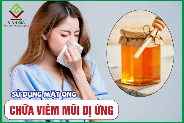 Mật ong và nghệ có tác dụng gì trong việc chữa viêm mũi dị ứng?
