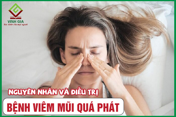 Những biện pháp phòng ngừa viêm mũi quá phát là gì?
