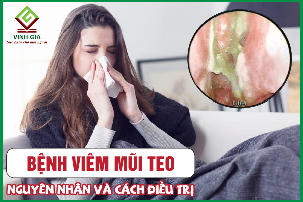 Viêm mũi teo có thể được chẩn đoán như thế nào?
