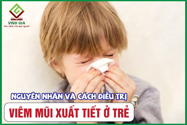 Nếu trẻ em bị viêm mũi xuất tiết, cần phải điều trị như thế nào?
